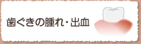 歯ぐきの腫れ・出血